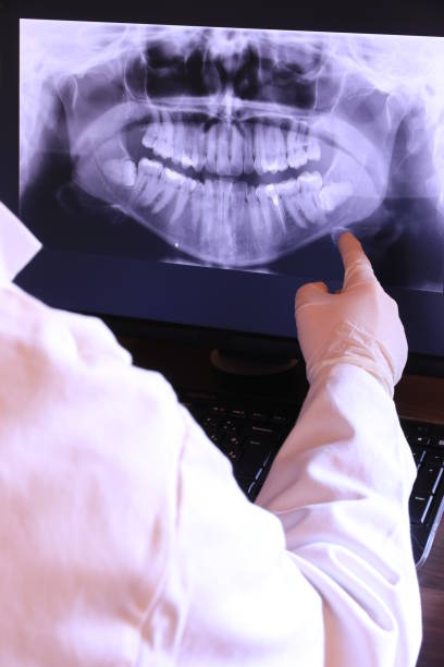 Best Emergency Dental Care for Broken or Chipped Teeth in Koloa, HI