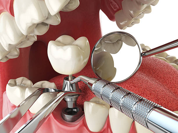 Fast & Reliable Emergency Dental Services in HI